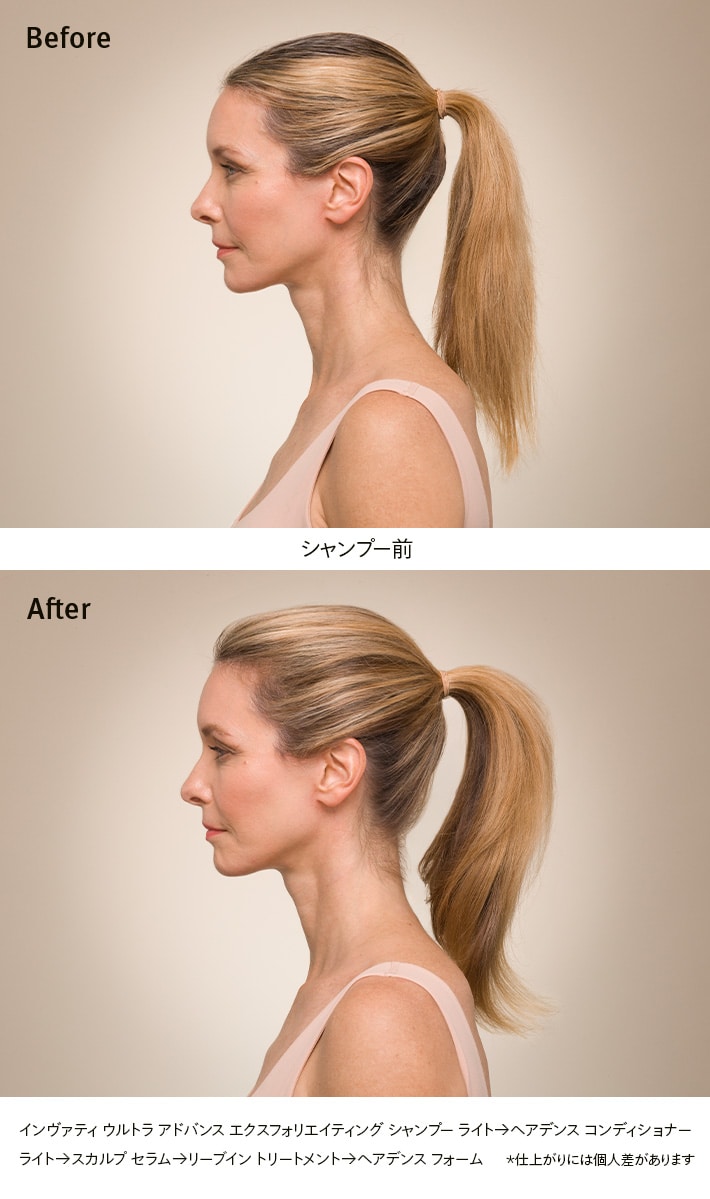 Invati Ultra Advance Trial Set